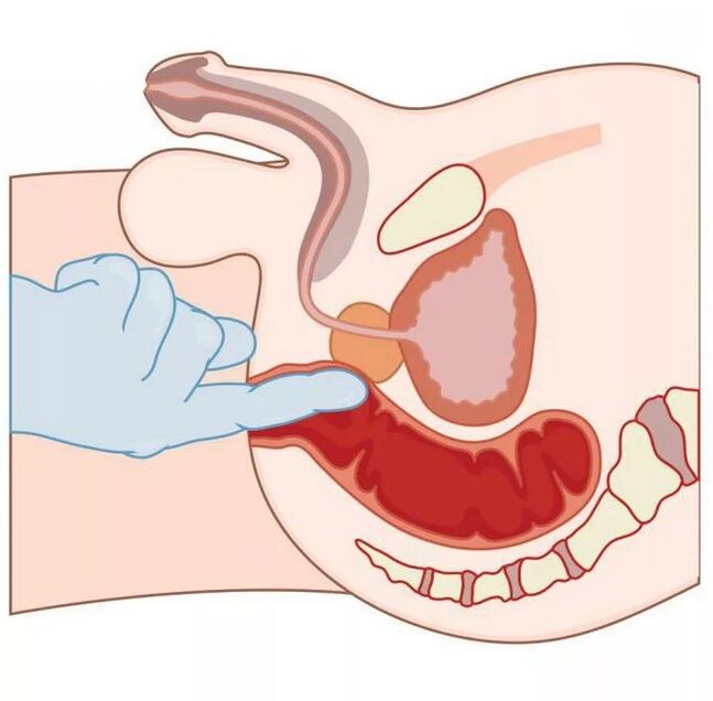 Lokalizacja męskiego punktu G